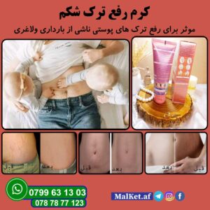 کرم رفع ترک شکم وکالی