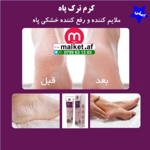 کرم رفع ترک پاه