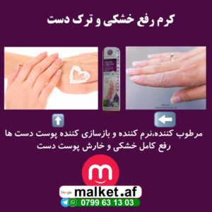 کرم رفع ترک و خشکی دست