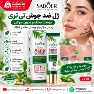 ژل ضدجوش تیتری SADOER کنترل چربی پوست